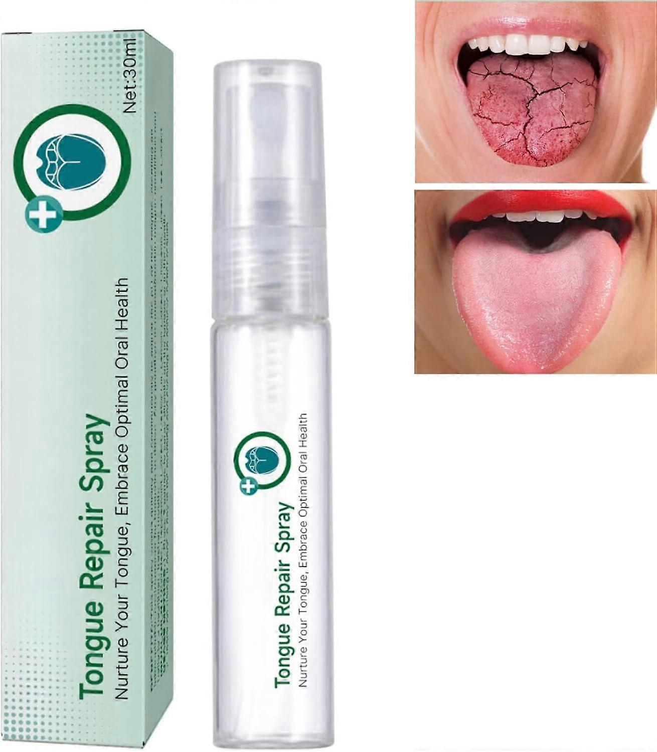 Tongue Repair Spray, Mouth Odor Eliminator for Dryness& Bad Breath,Fissured Tongue Relief Spray, Ins